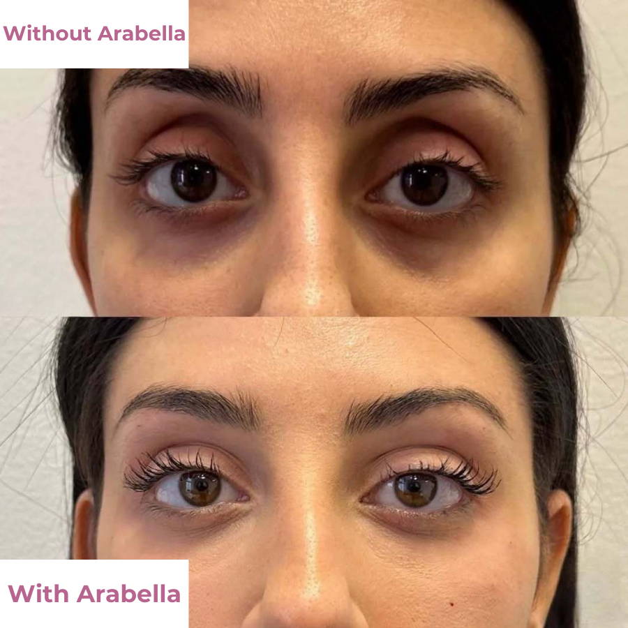 Arabella Smooth & Plump Eye Balm