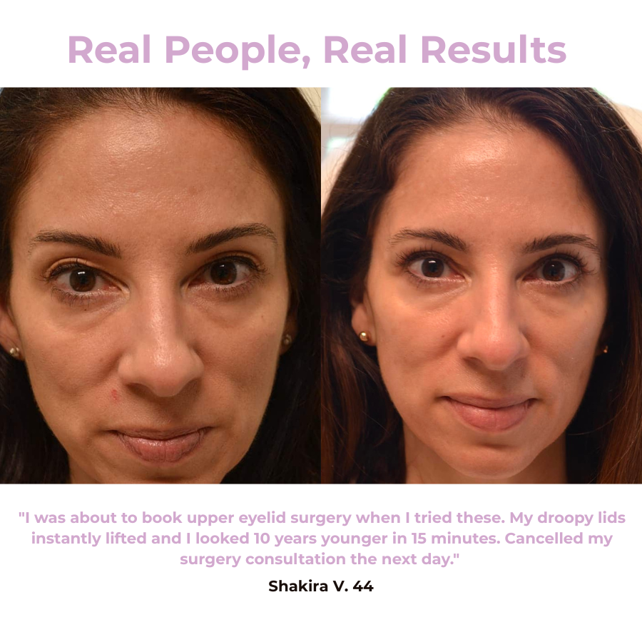 Svana Instant Tightening Eye Patches