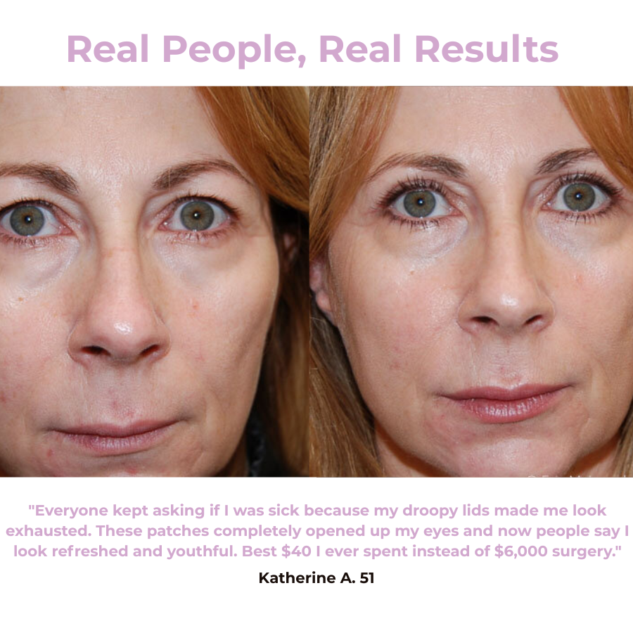 Svana Instant Tightening Eye Patches