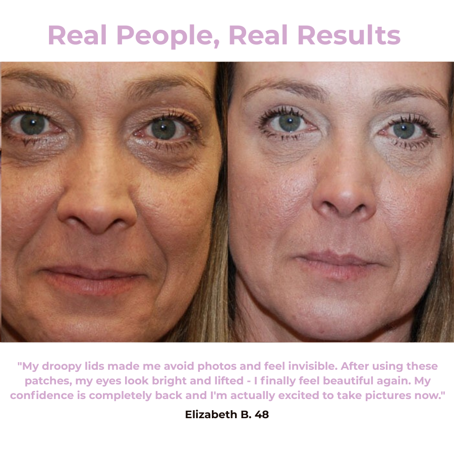 Svana Instant Tightening Eye Patches