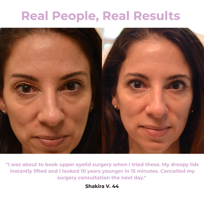 Svana Instant Tightening Eye Patches