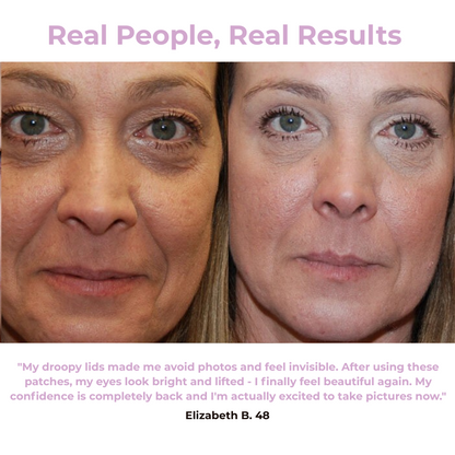 Svana Instant Tightening Eye Patches